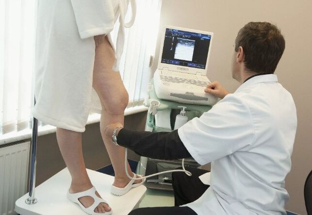 Diagnóstico de varices