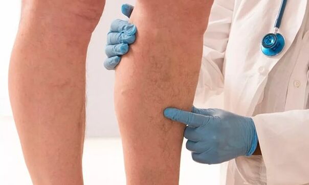 O doutor examina as pernas en busca de varices